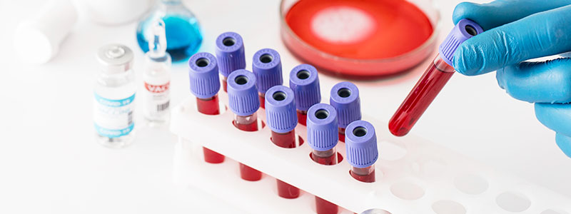 IVF Laboratory Tests cost in Siliguri