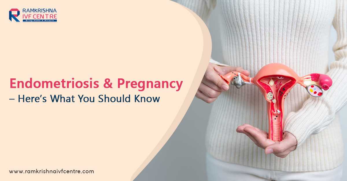 Endometriosis And Pregnancy – Here’s What You Should Know