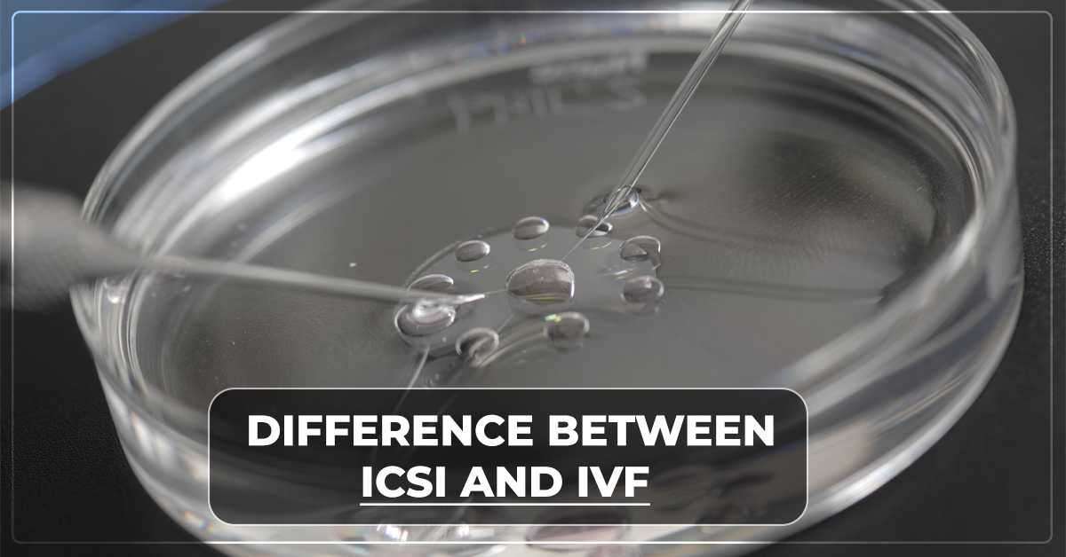 Difference between ICSI and IVF