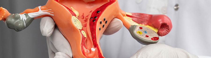 Hystero-Salpingogram(HSG)